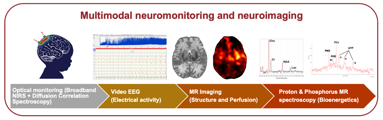 neonatal_neuromonitoring_and_neuroimaging