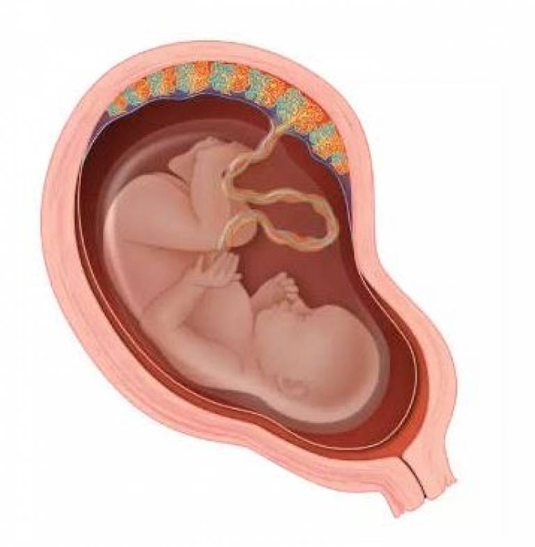image of baby in womb