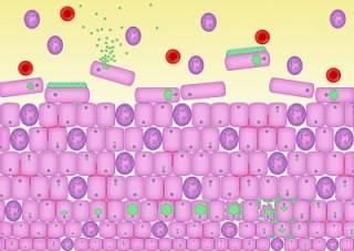 How urinary pathogens become embedded in the epithelium of the bladder